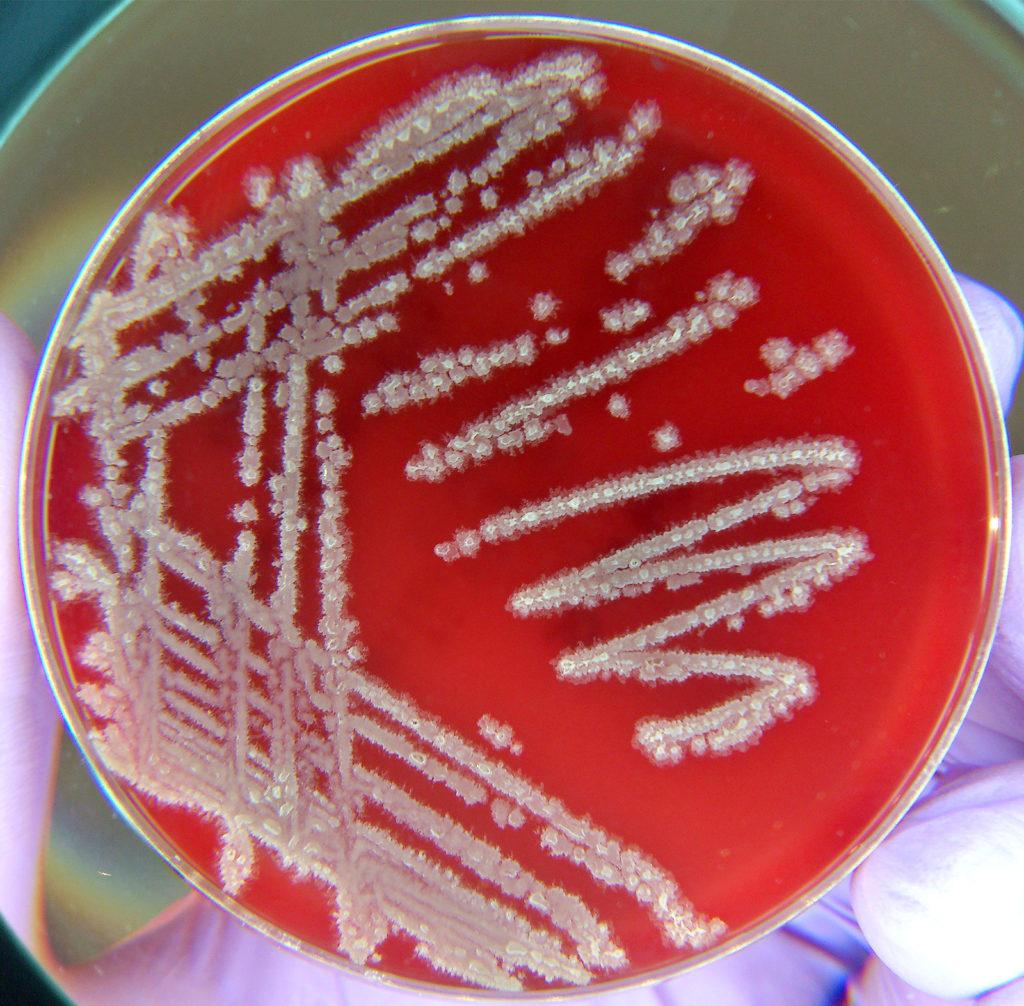 Licheniformis – NutraWiki